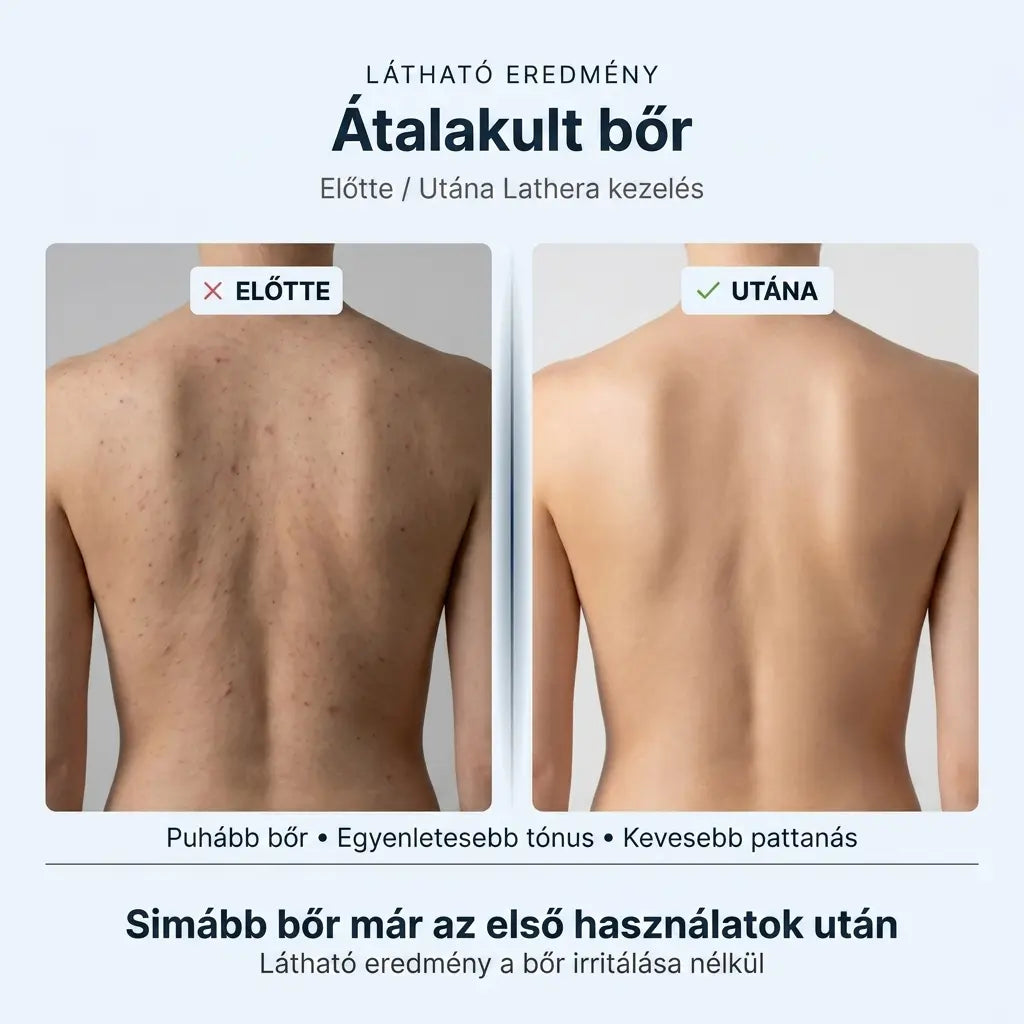 Lathera™ bőrradírozó zuhany törölköző