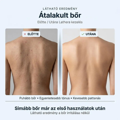 Lathera™ bőrradírozó zuhany törölköző